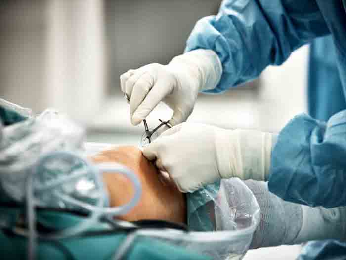 Hospitalization