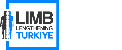 Limb Lengthening Turkiye | Change Your Life
